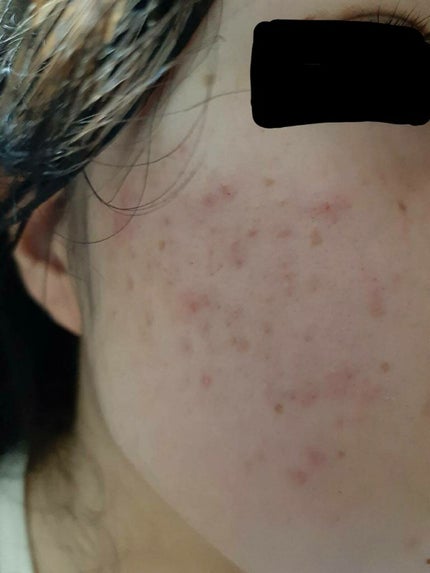 を使ったクチコミ(1枚目)