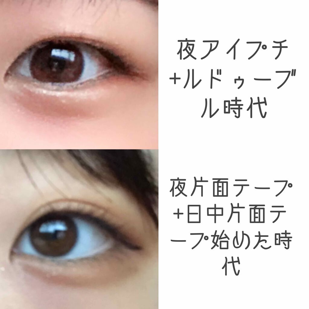 のびーるアイテープ（絆創膏タイプ、レギュラー）/DAISO/二重まぶた用アイテムを使ったクチコミ（2枚目）