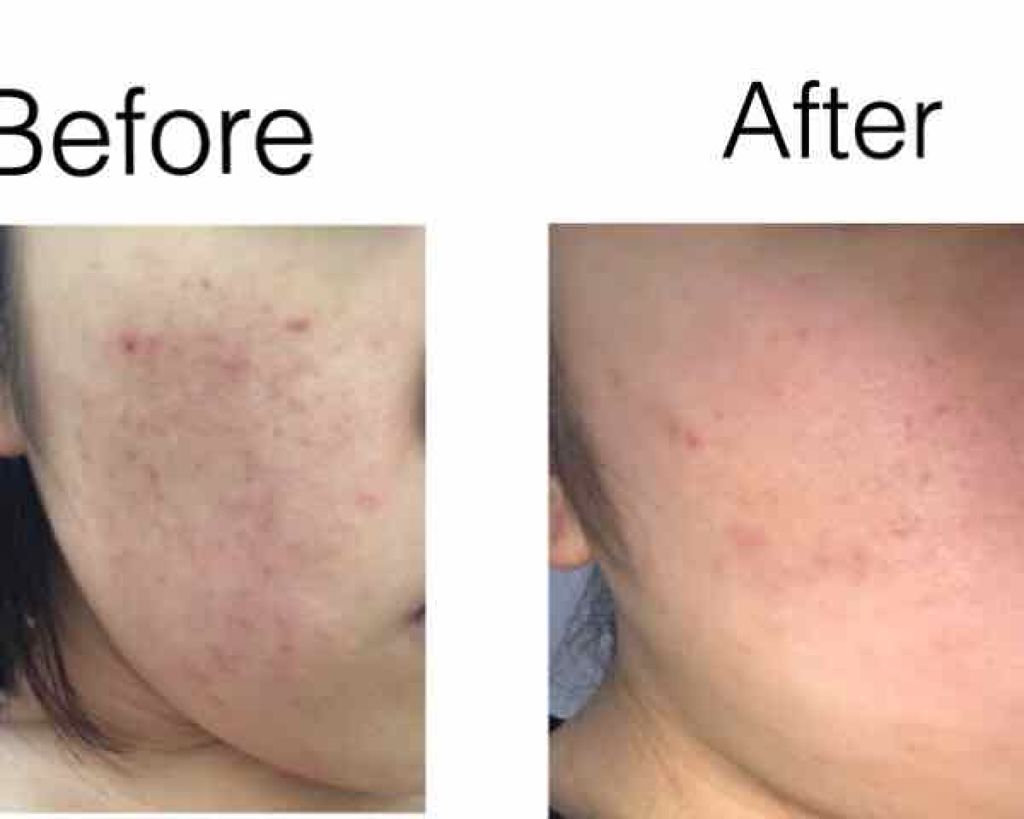 明色美顔水 薬用化粧水/美顔/化粧水を使ったクチコミ（2枚目）