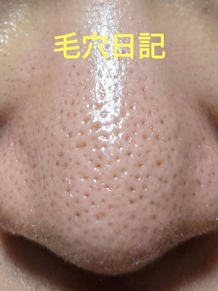 デュオ ザ クレンジングバーム/DUO/クレンジングバームを使ったクチコミ(1枚目)