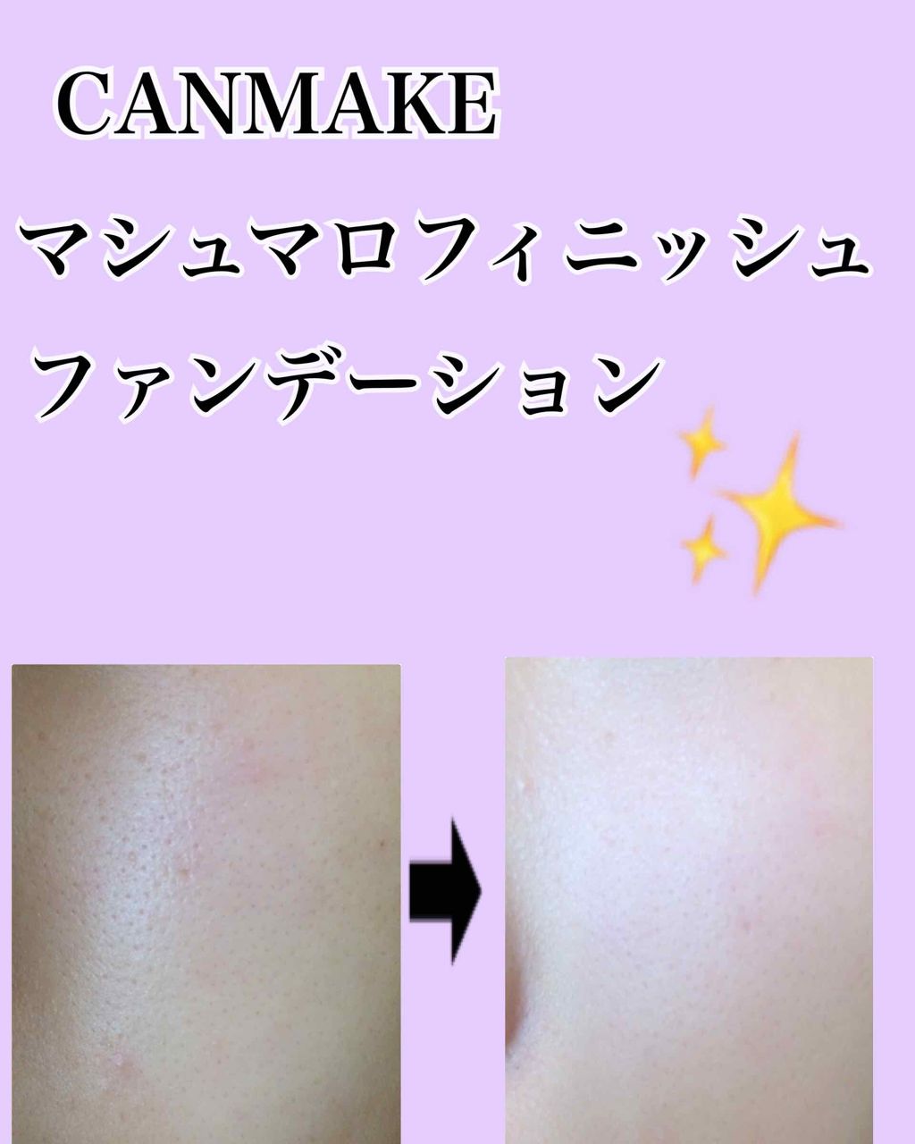 マシュマロフィニッシュファンデーション/キャンメイク/パウダーファンデーションを使ったクチコミ(1枚目)