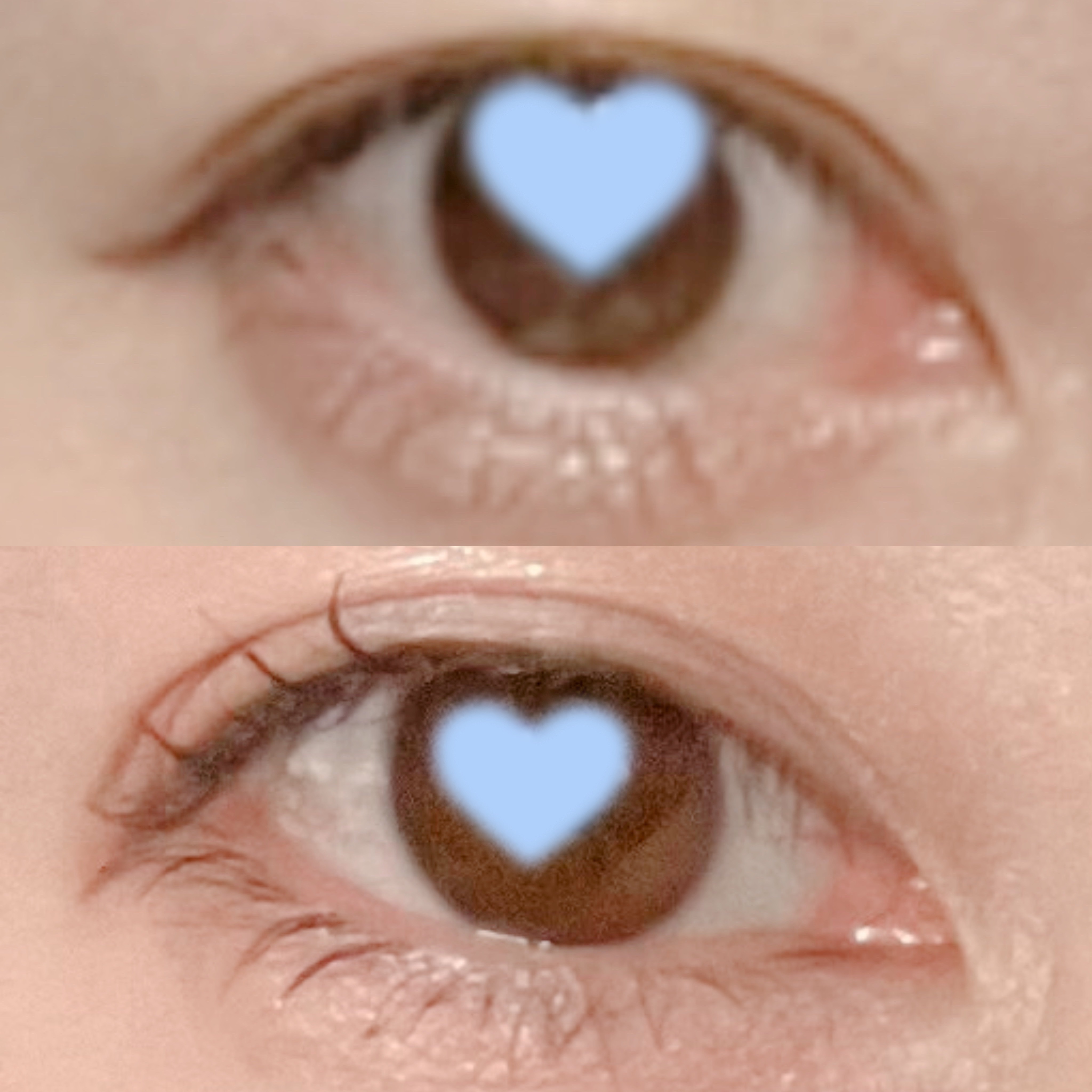 ひとえ・奥ぶたえ用カーラー/アイプチ®/ビューラーを使ったクチコミ（3枚目）