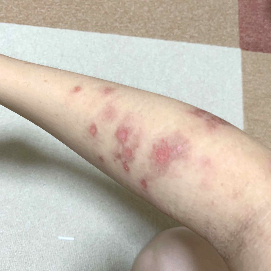 キャッチ・エム・オール ピカシュウ クレンジング オイル キット/shu uemura/スキンケアキットを使ったクチコミ（3枚目）