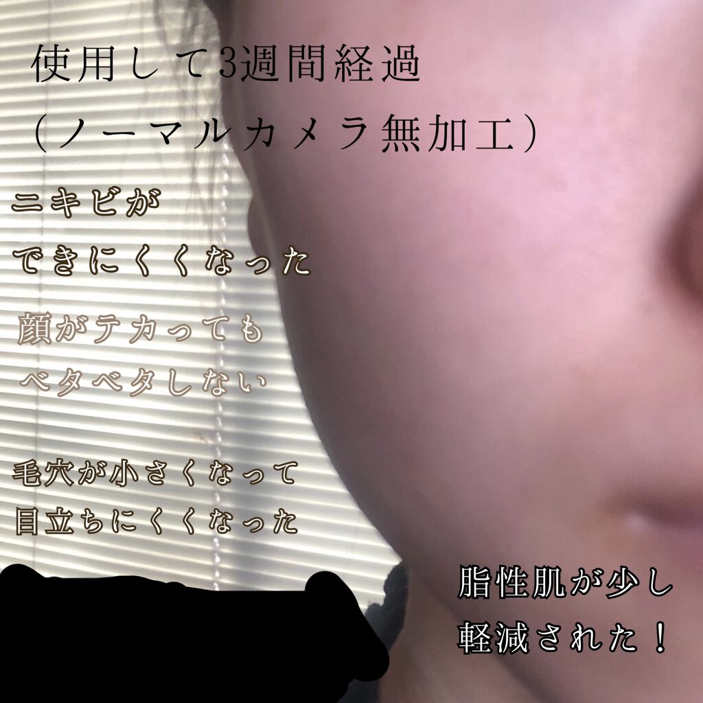 エリクシール ルフレ バランシング ミルク I/エリクシール/乳液を使ったクチコミ（2枚目）