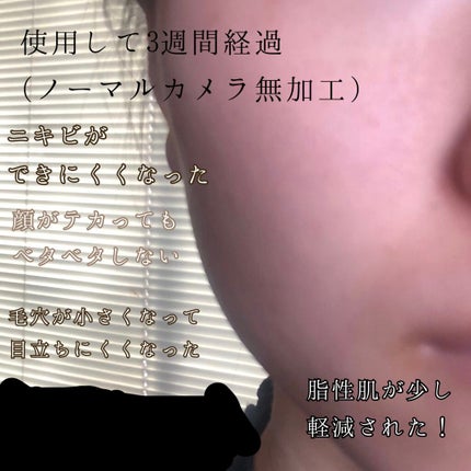 エリクシール ルフレ バランシング ウォーター I/エリクシール/化粧水を使ったクチコミ(2枚目)