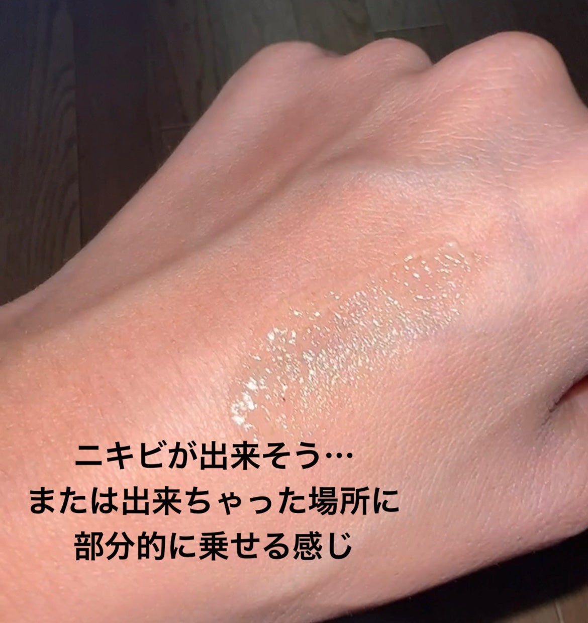 AC アクネスポッツ/BENEFIQUE/美容液を使ったクチコミ(4枚目)