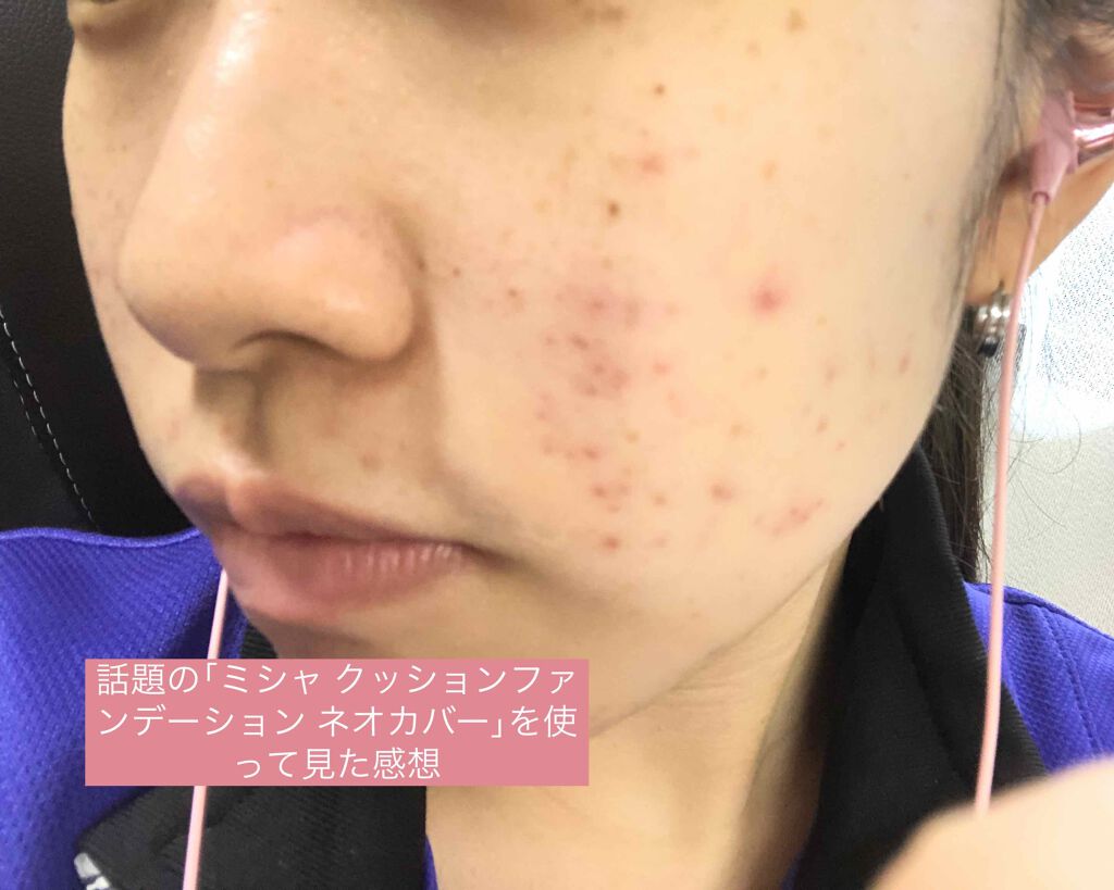 M クッションファンデーション(ネオカバー)/MISSHA/クッションファンデーションを使ったクチコミ(1枚目)