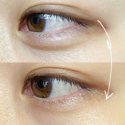 ピントアップ アイセラム /Pintup/アイケア・アイクリームを使ったクチコミ(5枚目)