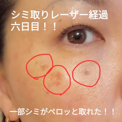 を使ったクチコミ(1枚目)