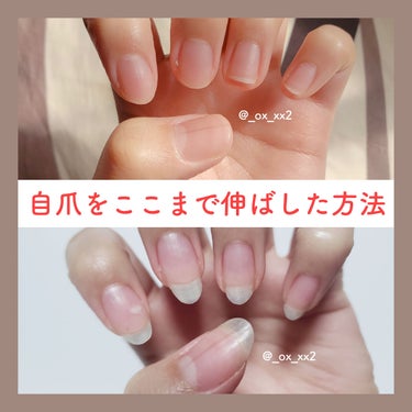 Dr.Nail デイケアオイルのクチコミ「自爪をここまで伸ばした方法♡どちらも左手です！



【おすすめのケア商品】

◆Dr.Nai.....」（1枚目）