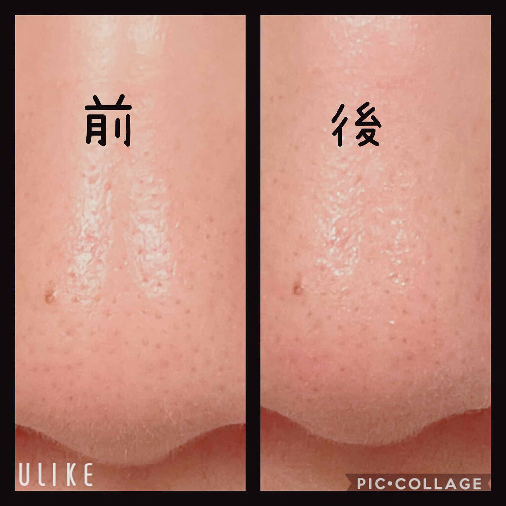 ロゼットゴマージュ モイスト/ロゼット/ピーリングを使ったクチコミ（2枚目）