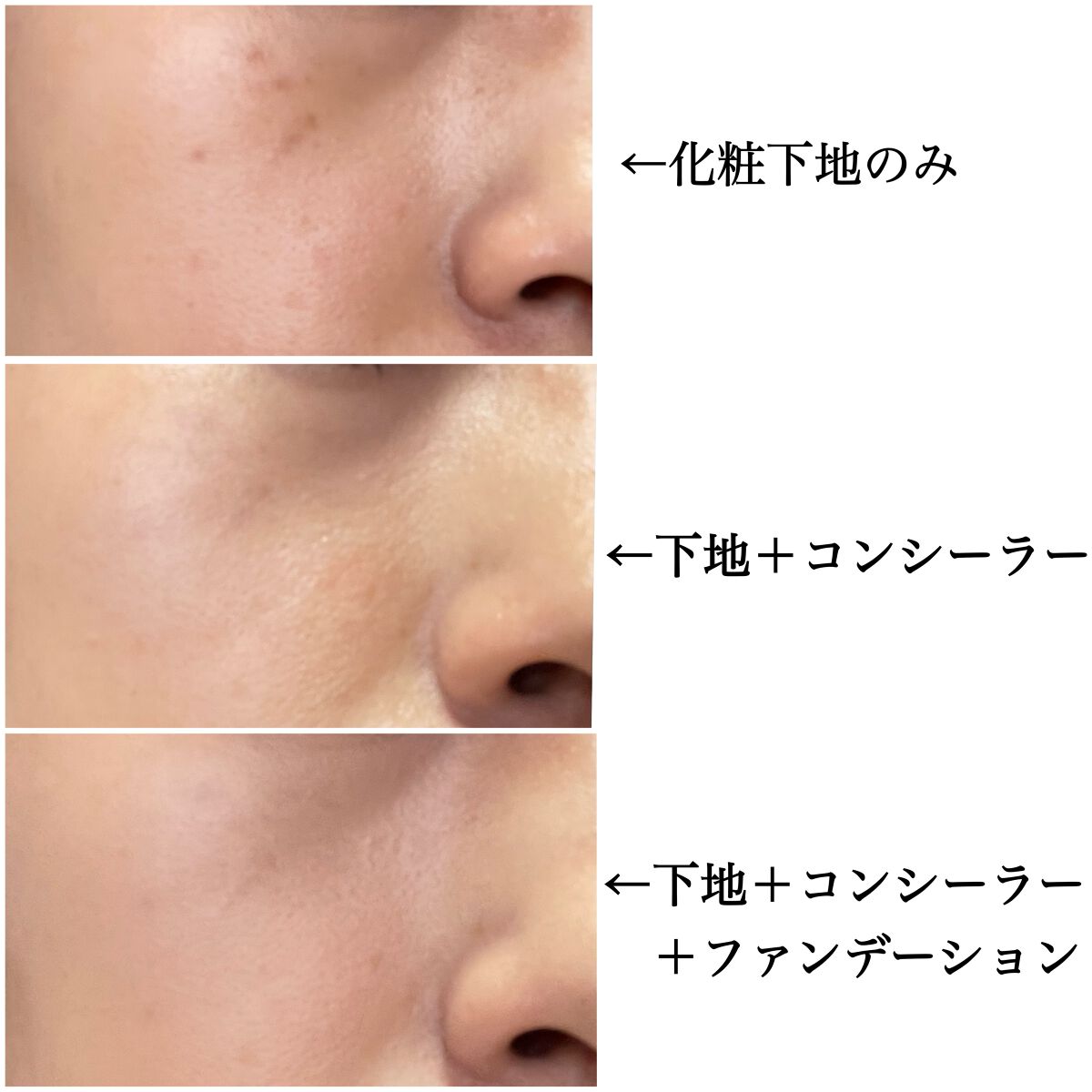 ミネラルコンシーラーパレット/エトヴォス/パレットコンシーラーを使ったクチコミ(5枚目)