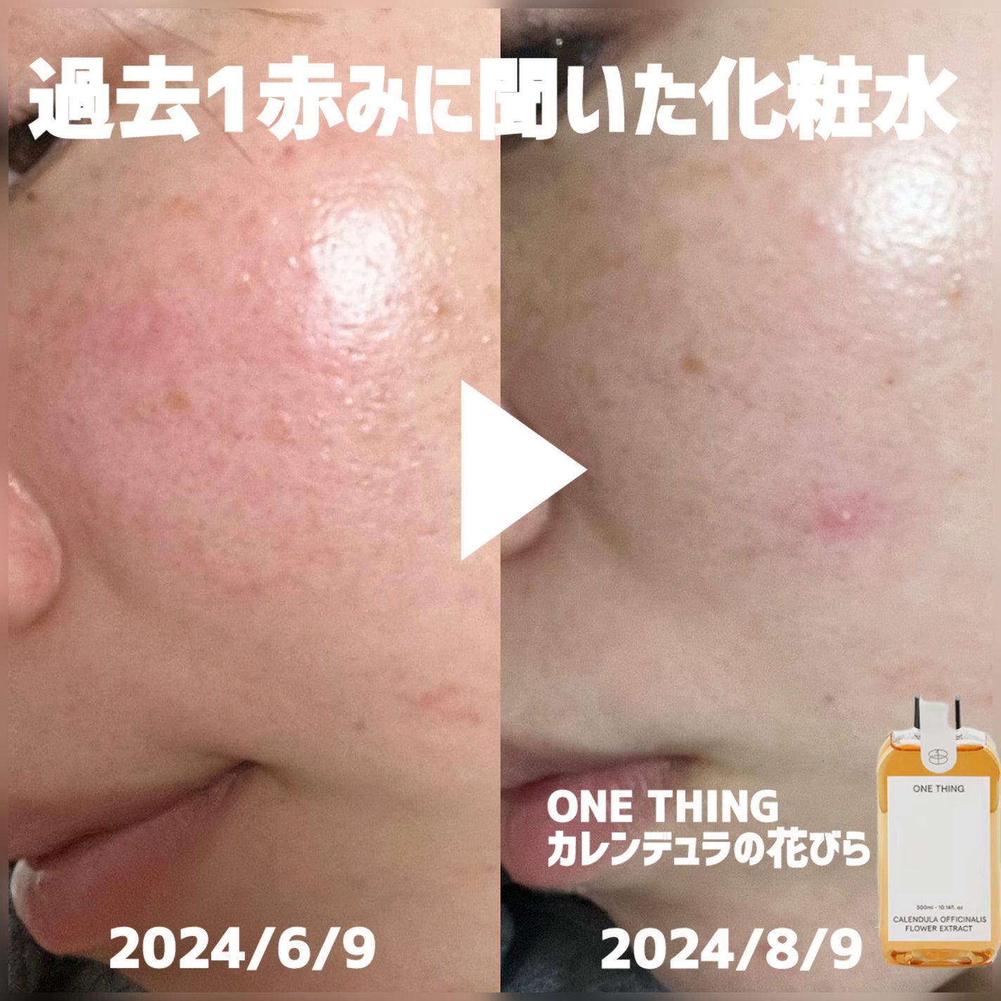 カレンデュラ化粧水/ONE THING/化粧水を使ったクチコミ(1枚目)