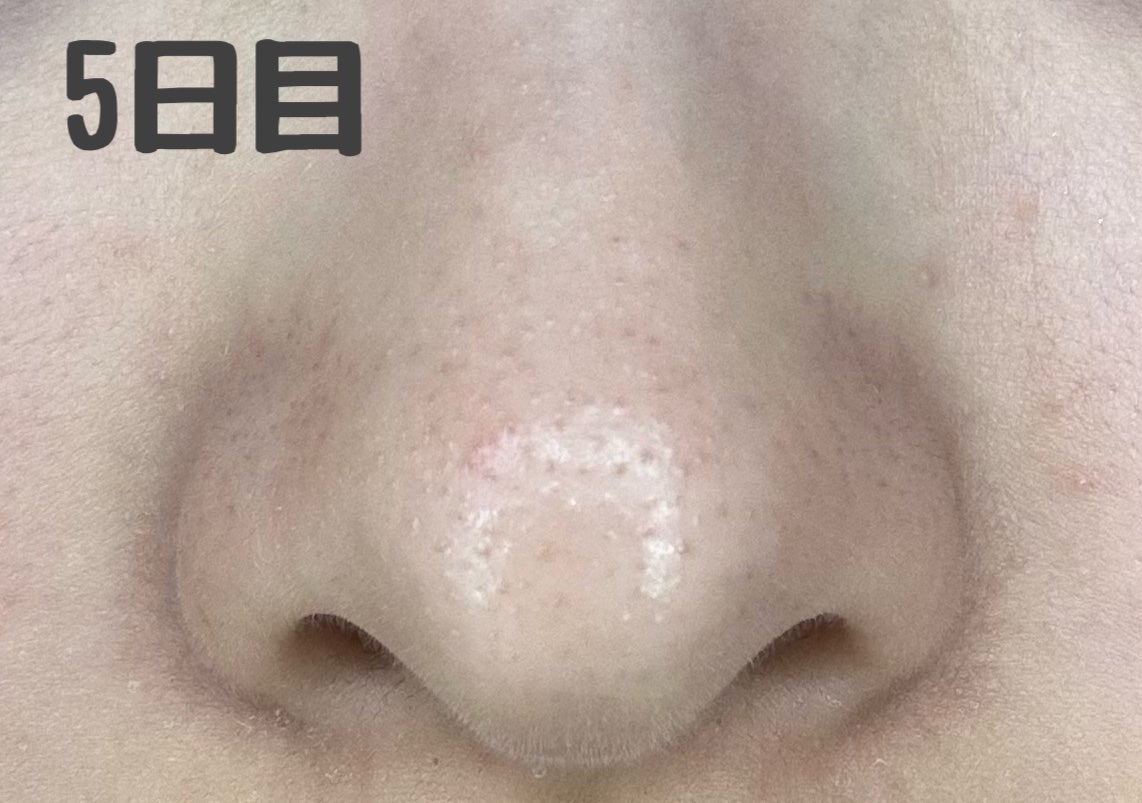 デュオ ザ クレンジングバーム ブラックリペア /DUO/クレンジングバームを使ったクチコミ(6枚目)