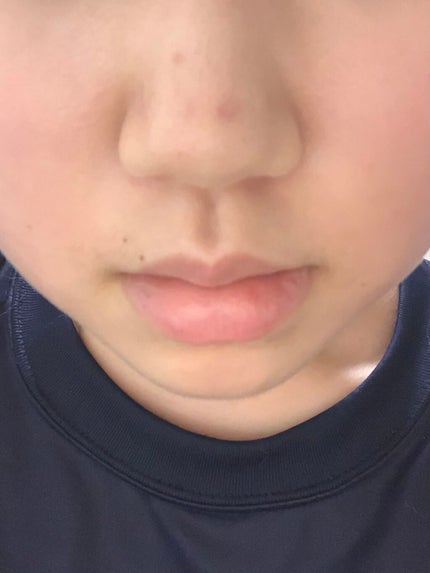 を使ったクチコミ(1枚目)