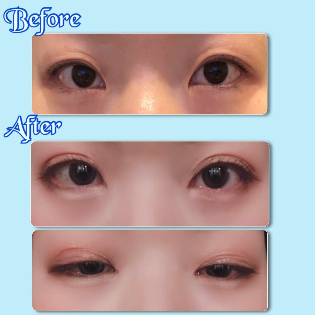 リアルダブルアイリッド/K-パレット/二重まぶた用アイテムを使ったクチコミ(3枚目)