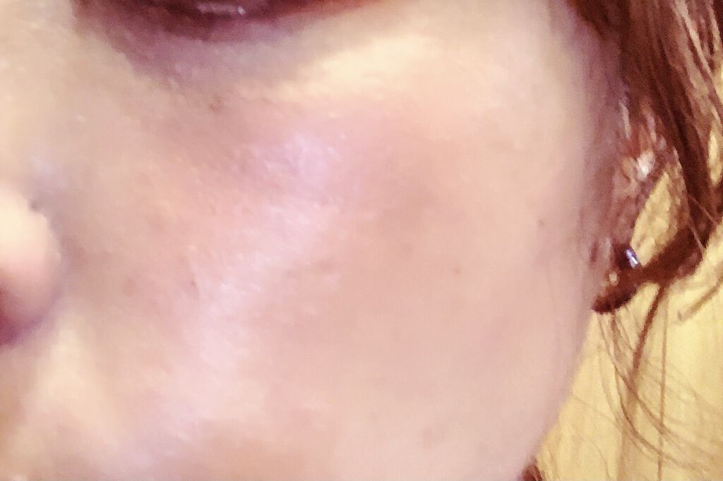 資生堂ベビーパウダー(プレスド)/ベビー/ボディパウダーを使ったクチコミ（2枚目）