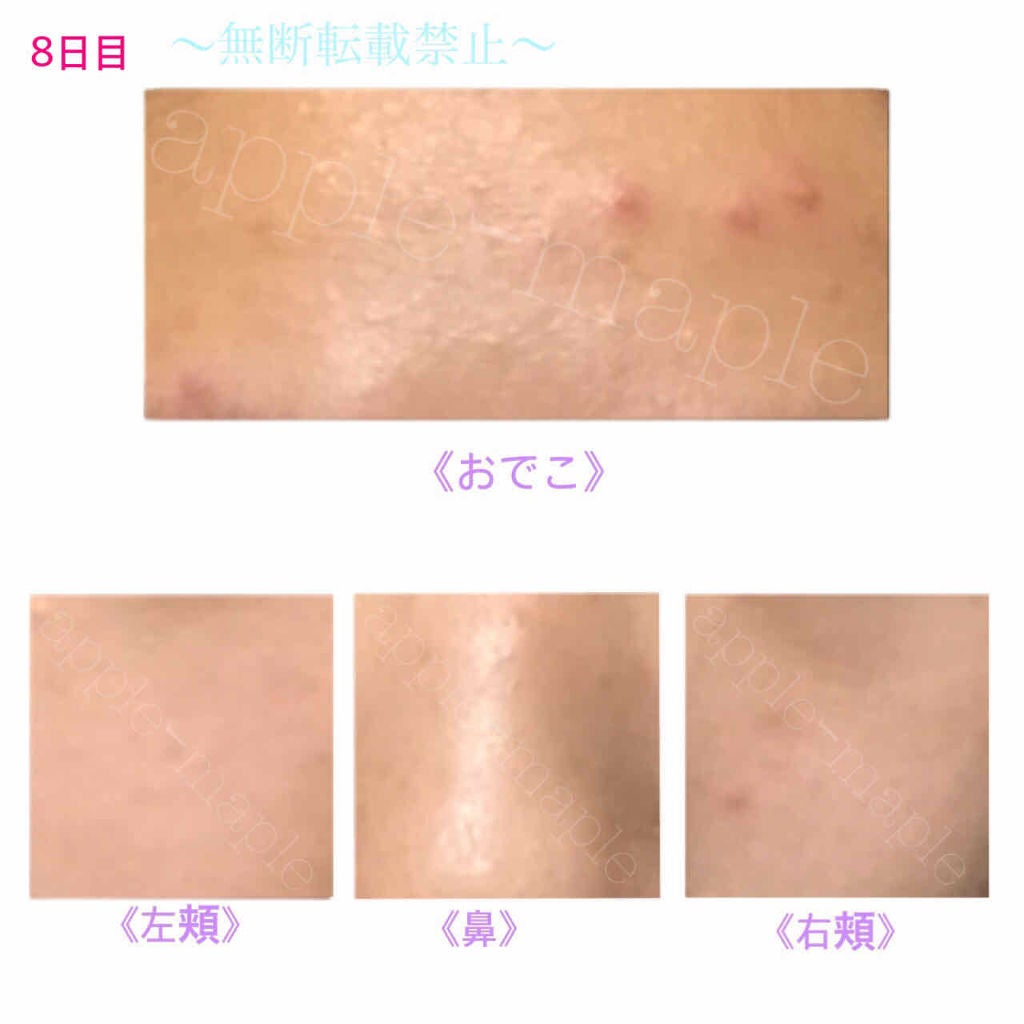 ロゼット 洗顔パスタ 荒性肌/ロゼット/洗顔フォームを使ったクチコミ(2枚目)