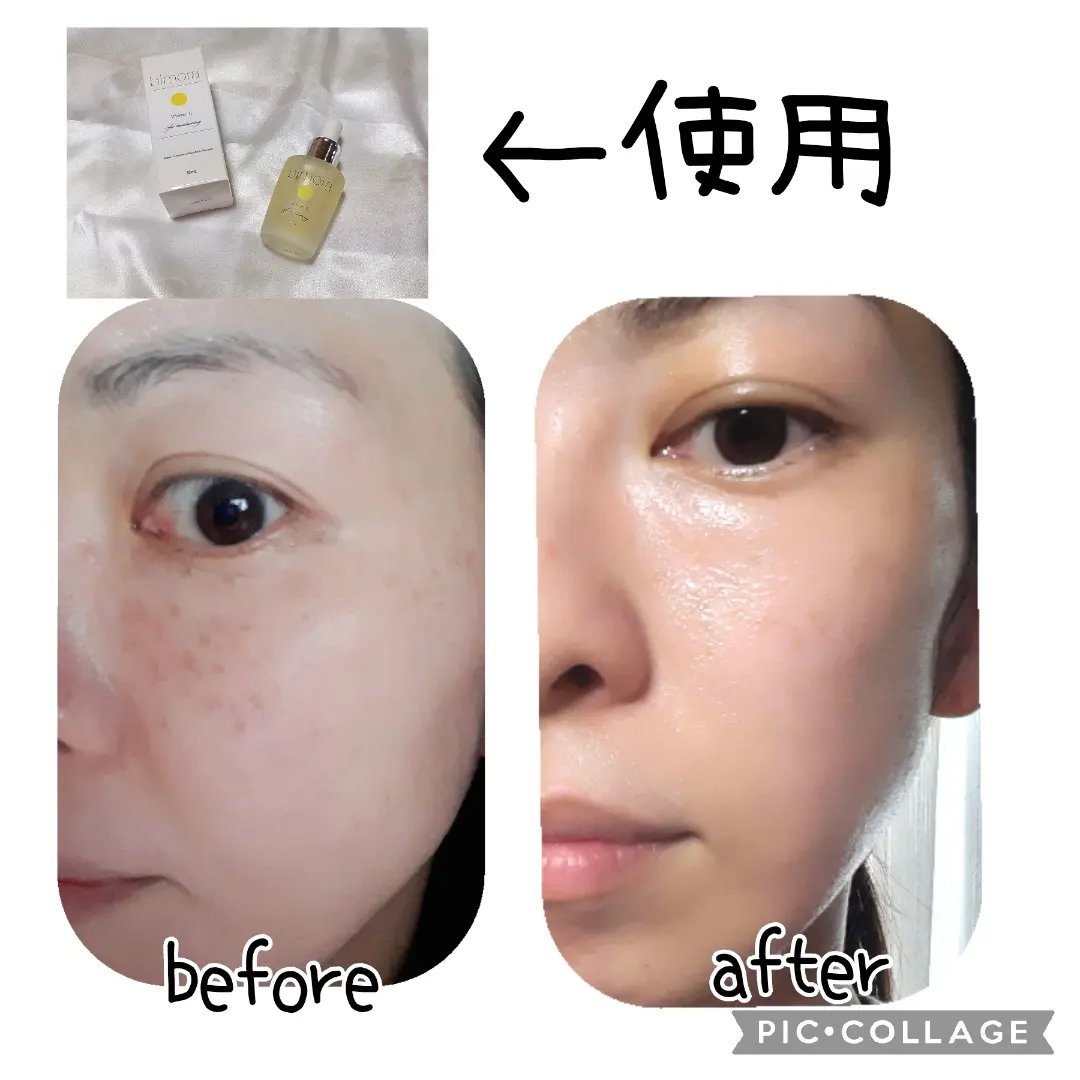 ビモラコスメ VC/BimoRa/美容液を使ったクチコミ（2枚目）