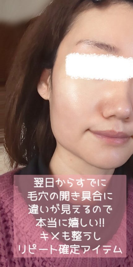 マデセラフレッシュクリアリングアンプル/SKINRx LAB/美容液を使ったクチコミ(4枚目)