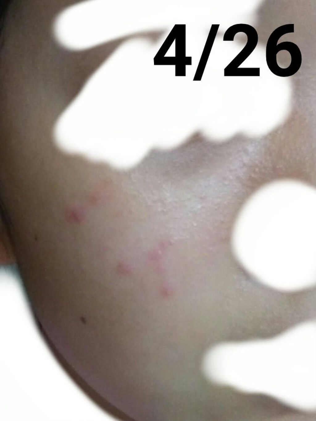 ロゼット洗顔パスタ アクネクリア/ロゼット/洗顔フォームを使ったクチコミ（2枚目）