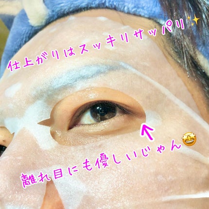 弱酸性pHシートマスク ドクダミフィット/Abib /シートマスク・パックを使ったクチコミ(4枚目)