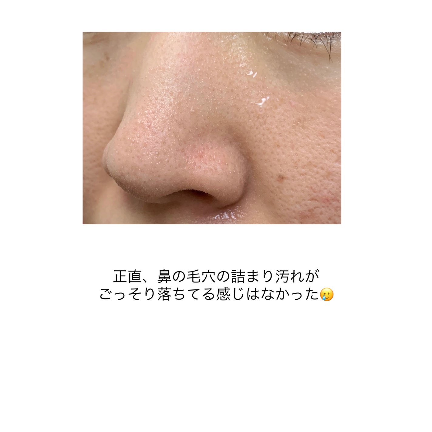 マイクロムース リフレッシャー/ALBLANC/泡洗顔を使ったクチコミ(6枚目)