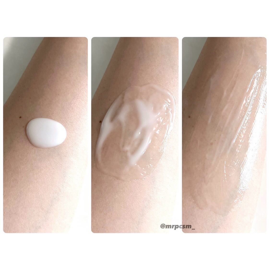 ãã¬ãã¢ã ããã£ãã«ã¯ ãã¯ã€ããã³ã°ãå»è¬éšå€åã /ããã¢/ããã£ãã«ã¯ã䜿ã£ãã¯ãã³ãïŒ3æç®ïŒ