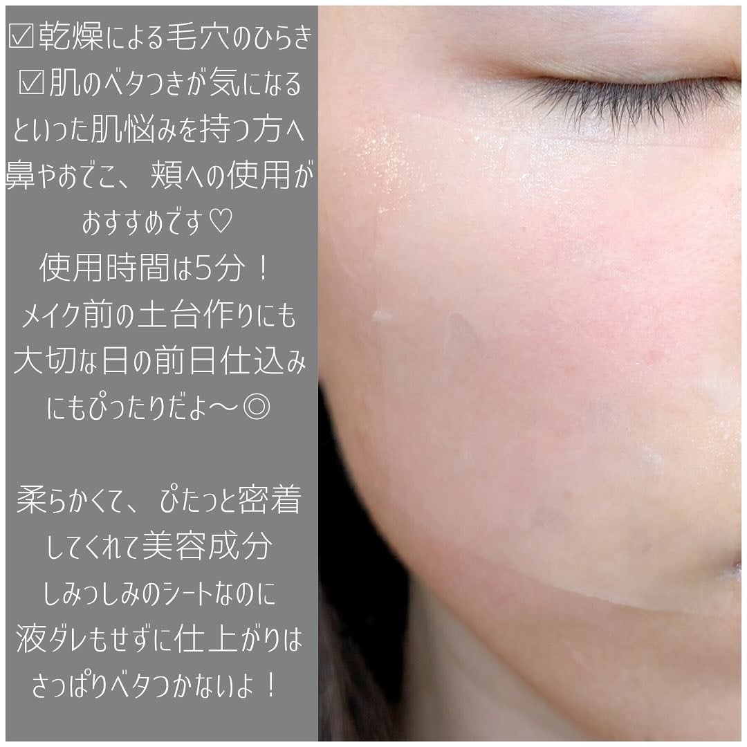 リズム べース ポイント集中パック(ブラック)/RISM/シートマスク・パックを使ったクチコミ(3枚目)