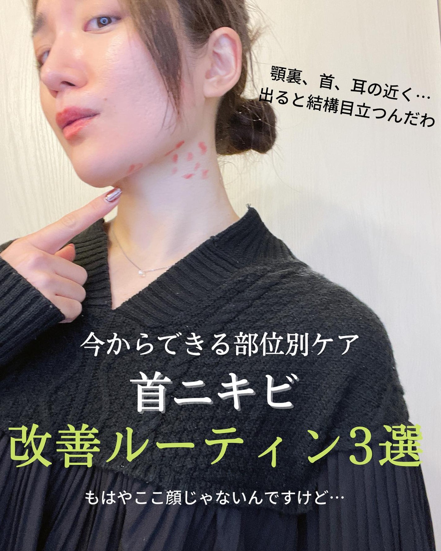 おゆみ|ニキビ・ニキビ跡ケア on LIPS 「【なぜそこに出来る?首のニキビ🤬🤬🤬】こんばんは、おゆみです。..」(1枚目)