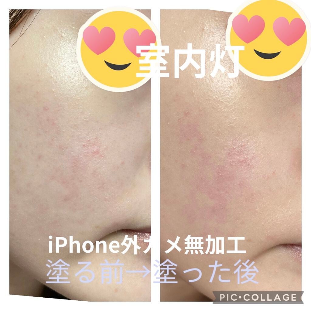 【旧】ディオールスキン フォーエヴァー フルイド グロウ/Dior/リキッドファンデーションを使ったクチコミ(6枚目)