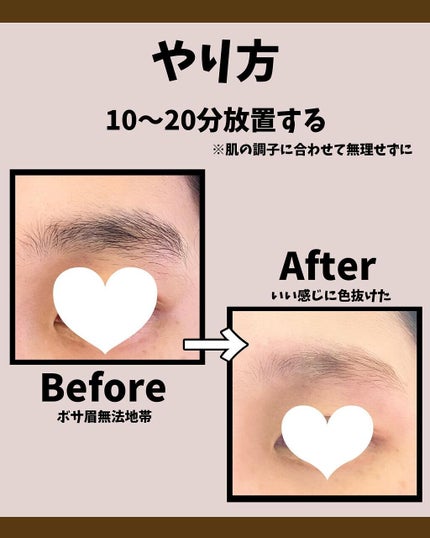 オリジナル ピュアスキンジェリー/ヴァセリン/ボディクリームを使ったクチコミ(7枚目)