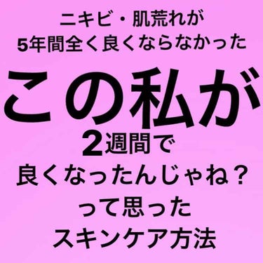 我的美麗日記（私のきれい日記）黒真珠化粧水/我的美麗日記/化粧水を使ったクチコミ（1枚目）