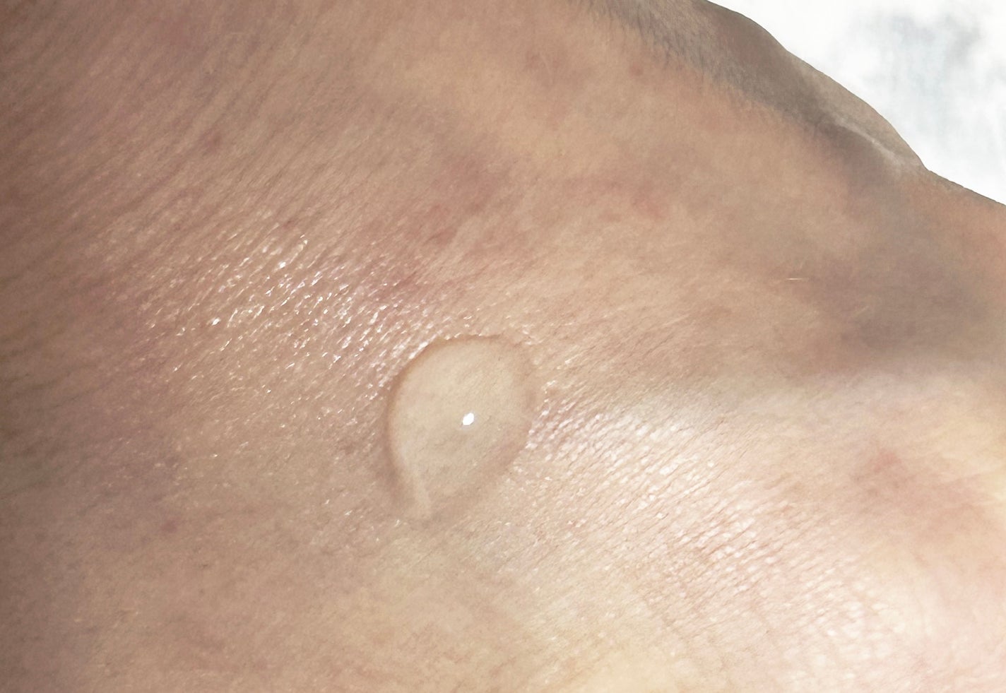 CHOI薬用クリアジェリーショット/肌美精/美容液を使ったクチコミ(3枚目)