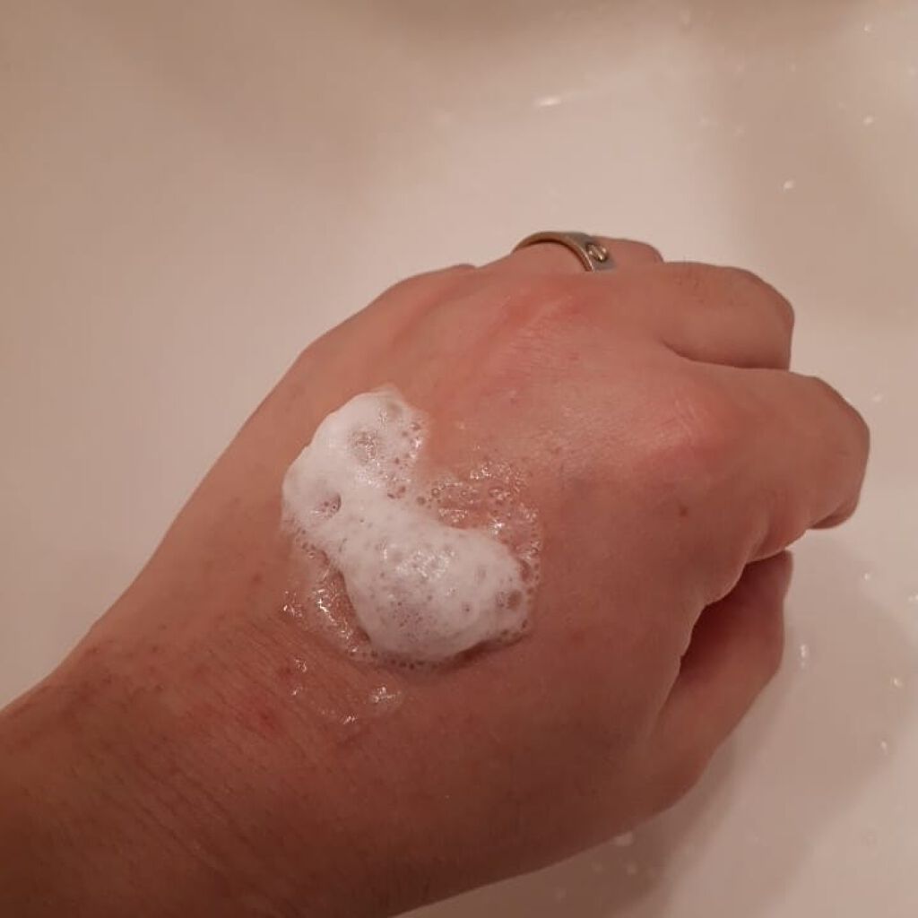 薬用スパークリング スカルプケア/ドクターベルツ/頭皮ローションを使ったクチコミ（2枚目）