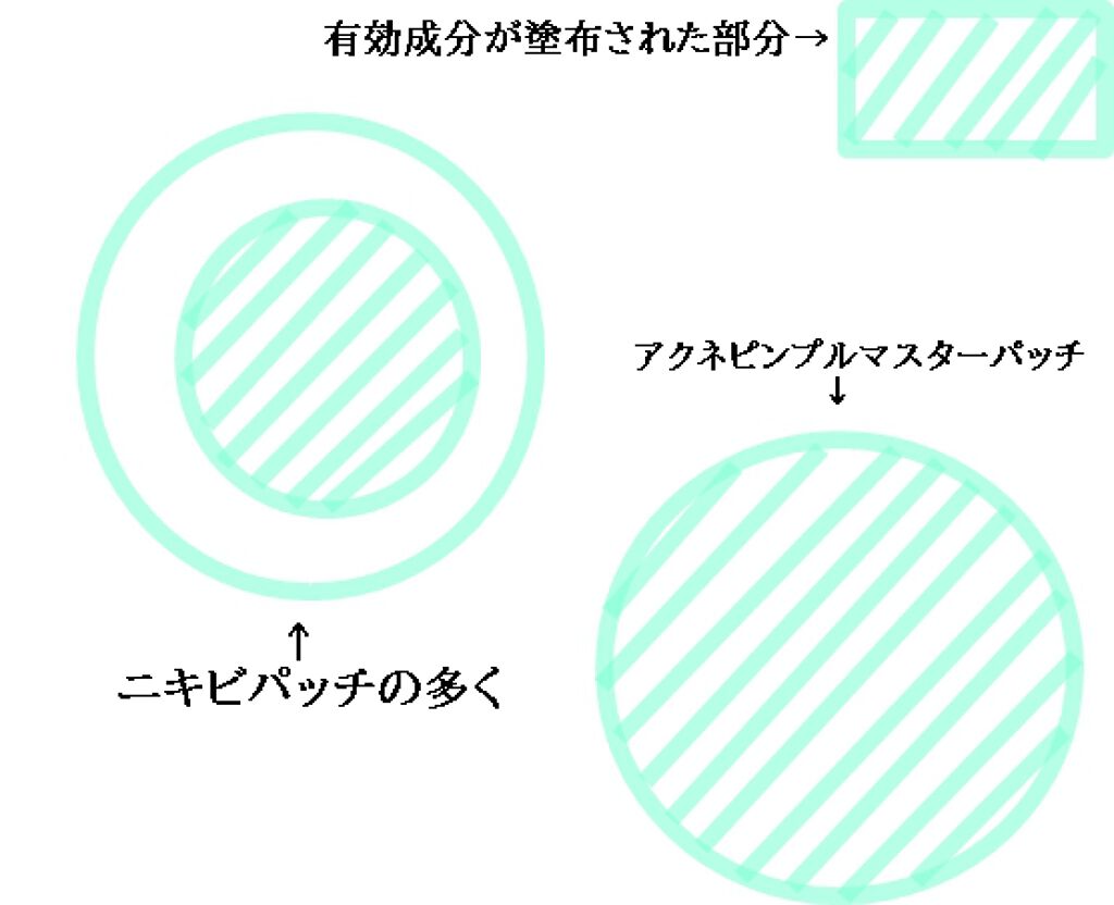 アクネピンプルマスターパッチ /COSRX/にきびパッチを使ったクチコミ(2枚目)