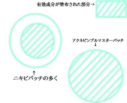 アクネピンプルマスターパッチ /COSRX/にきびパッチを使ったクチコミ(2枚目)