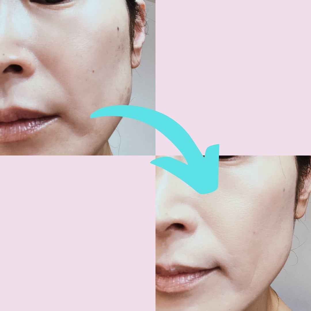 ラディアンスカラーセラム/Likebel/リキッドファンデーションを使ったクチコミ(4枚目)