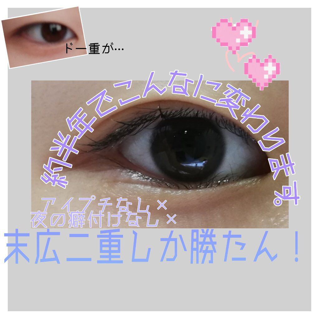 のびーるアイテープ（絆創膏タイプ、レギュラー）/DAISO/二重まぶた用アイテムを使ったクチコミ（1枚目）