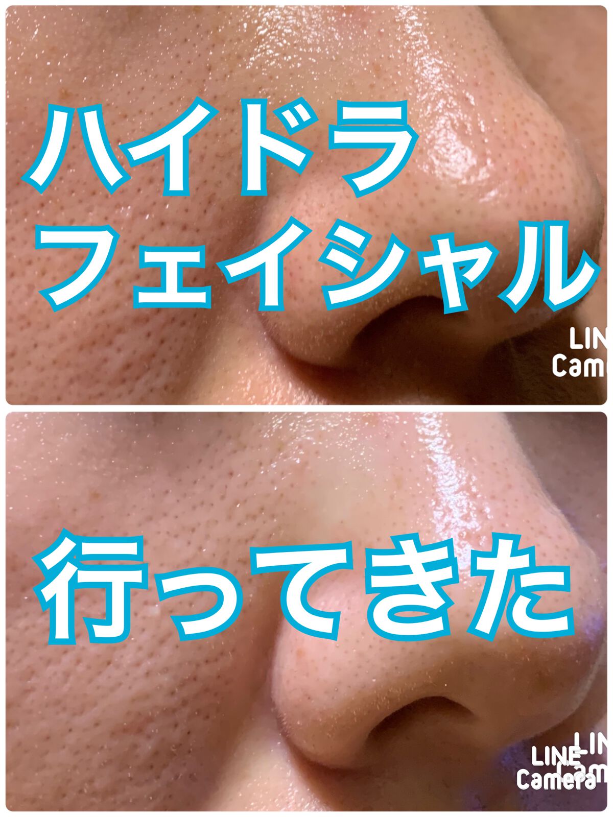 白潤プレミアム 薬用ジュレ状美白美容液/肌ラボ/美容液を使ったクチコミ（1枚目）