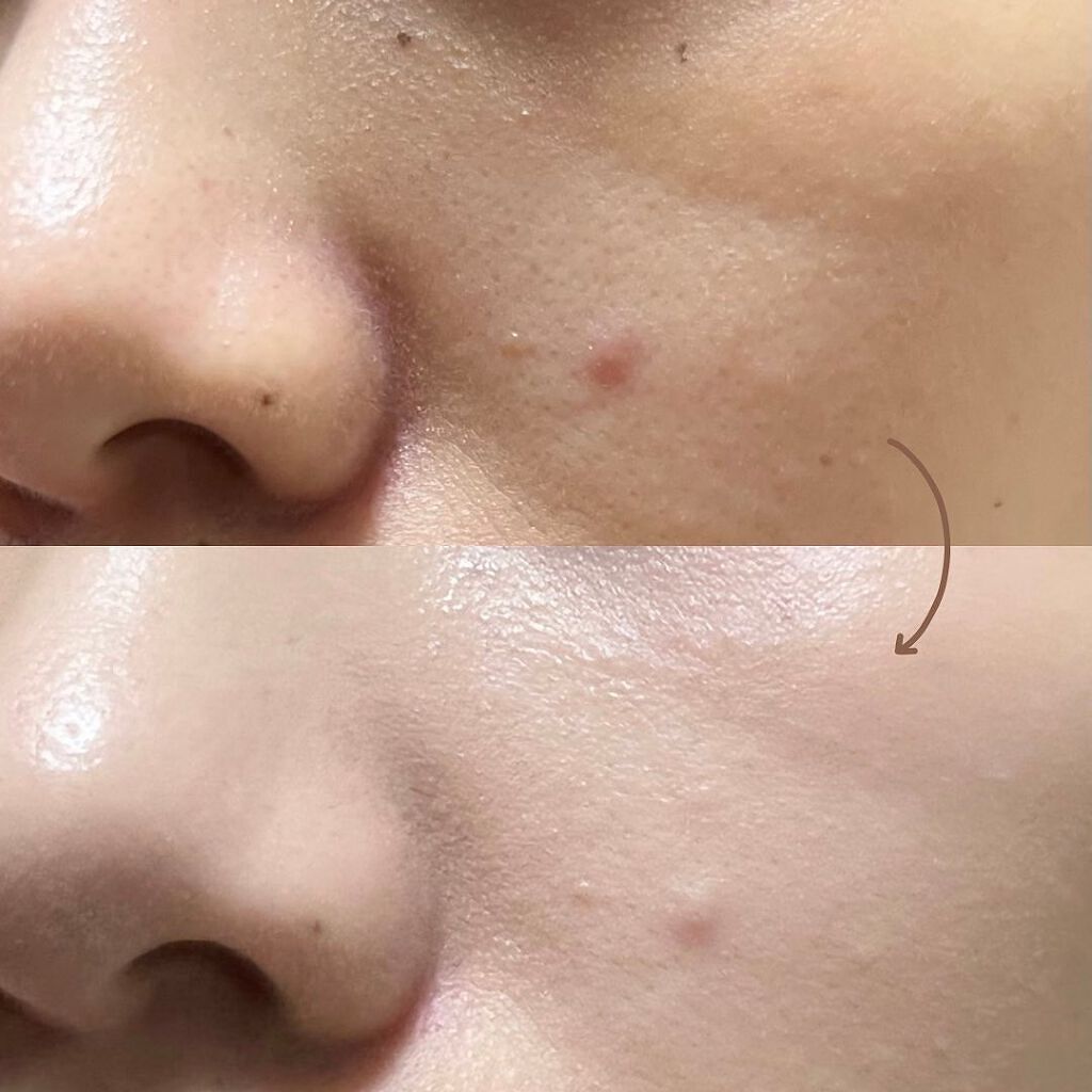 PURE'D100 PERFECTION クッションファンデ/ステファニー/クッションファンデーションを使ったクチコミ(8枚目)