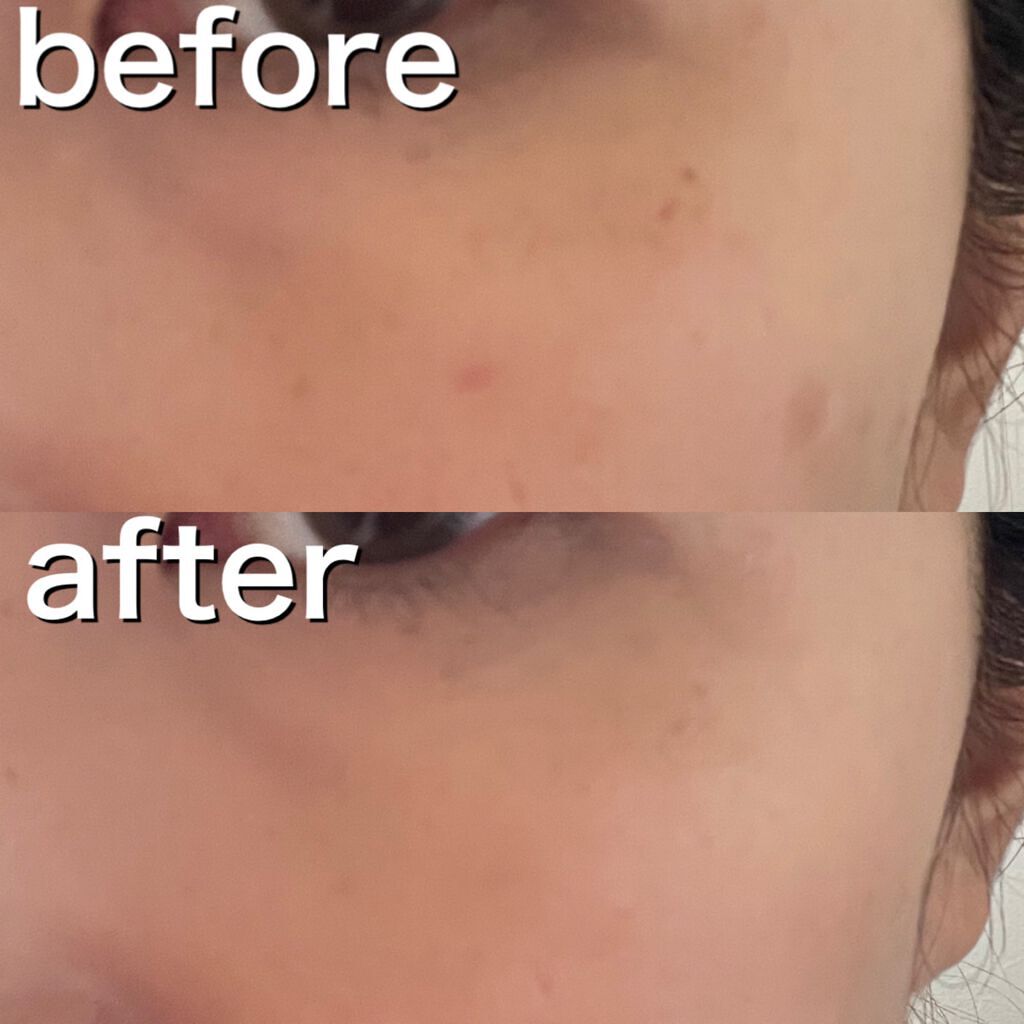 トーンパーフェクティング パレット/DECORTÉ/パレットコンシーラーを使ったクチコミ(2枚目)