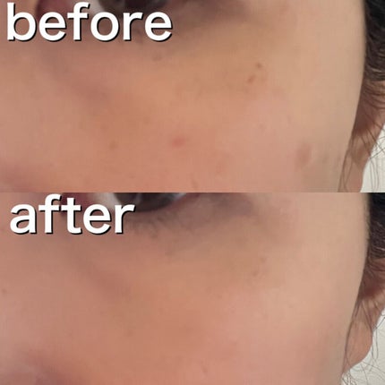 トーンパーフェクティング パレット/DECORTÉ/パレットコンシーラーを使ったクチコミ(2枚目)