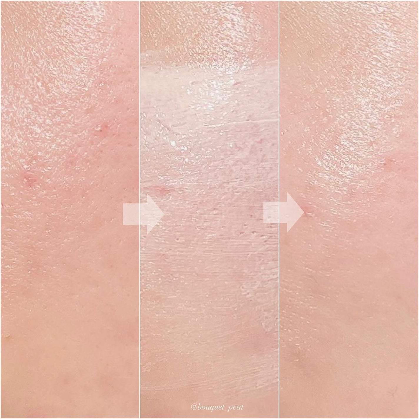 ドクタージー ブラックスネイル コラーゲンミスト/Dr.G/ミスト状化粧水を使ったクチコミ(8枚目)