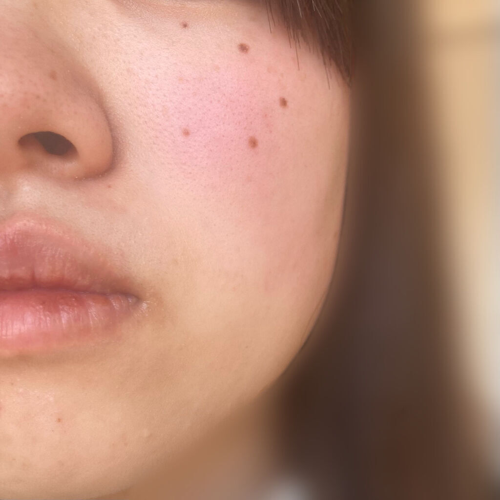 ノーモアブラックヘッド(ノーズピーリング)/One-day's you/スクラブ・ゴマージュを使ったクチコミ（3枚目）