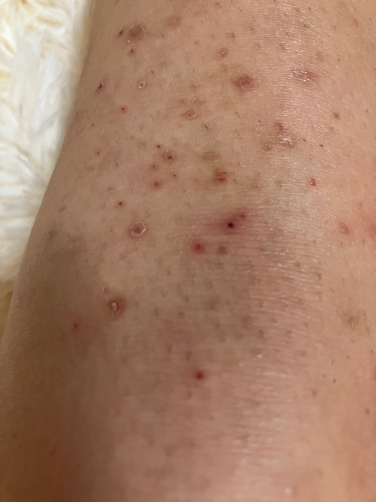 NONON/NONON(ノンノン)/除毛クリームを使ったクチコミ(4枚目)