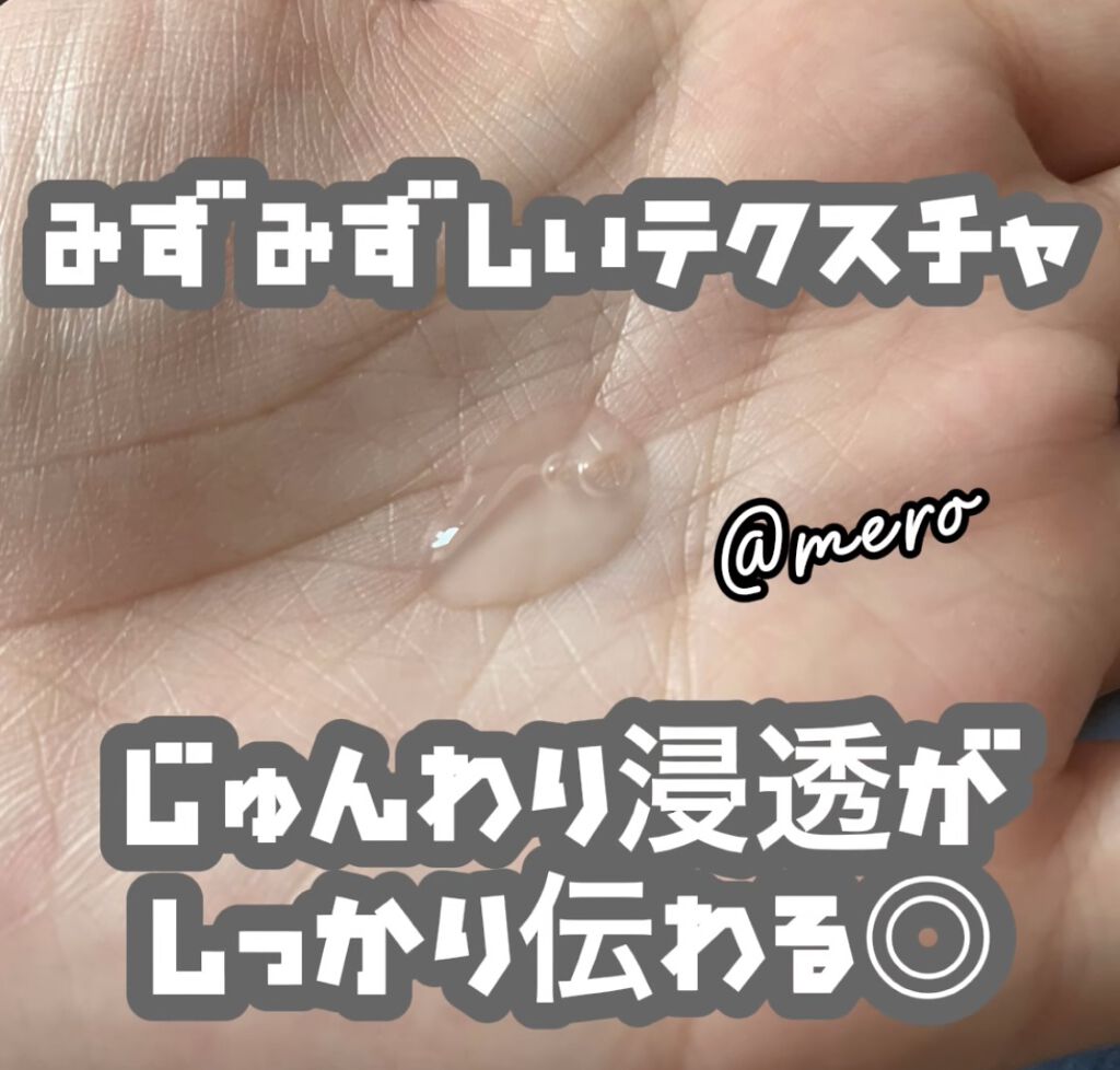 アクネケア ローション MB/d プログラム/化粧水を使ったクチコミ（2枚目）