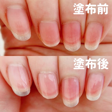 ストロングガード/D-UP/ネイル・ネイルケアを使ったクチコミ(4枚目)