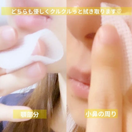 ビタペアC 集中美容液スペシャルセット/ネイチャーリパブリック/美容液を使ったクチコミ(7枚目)