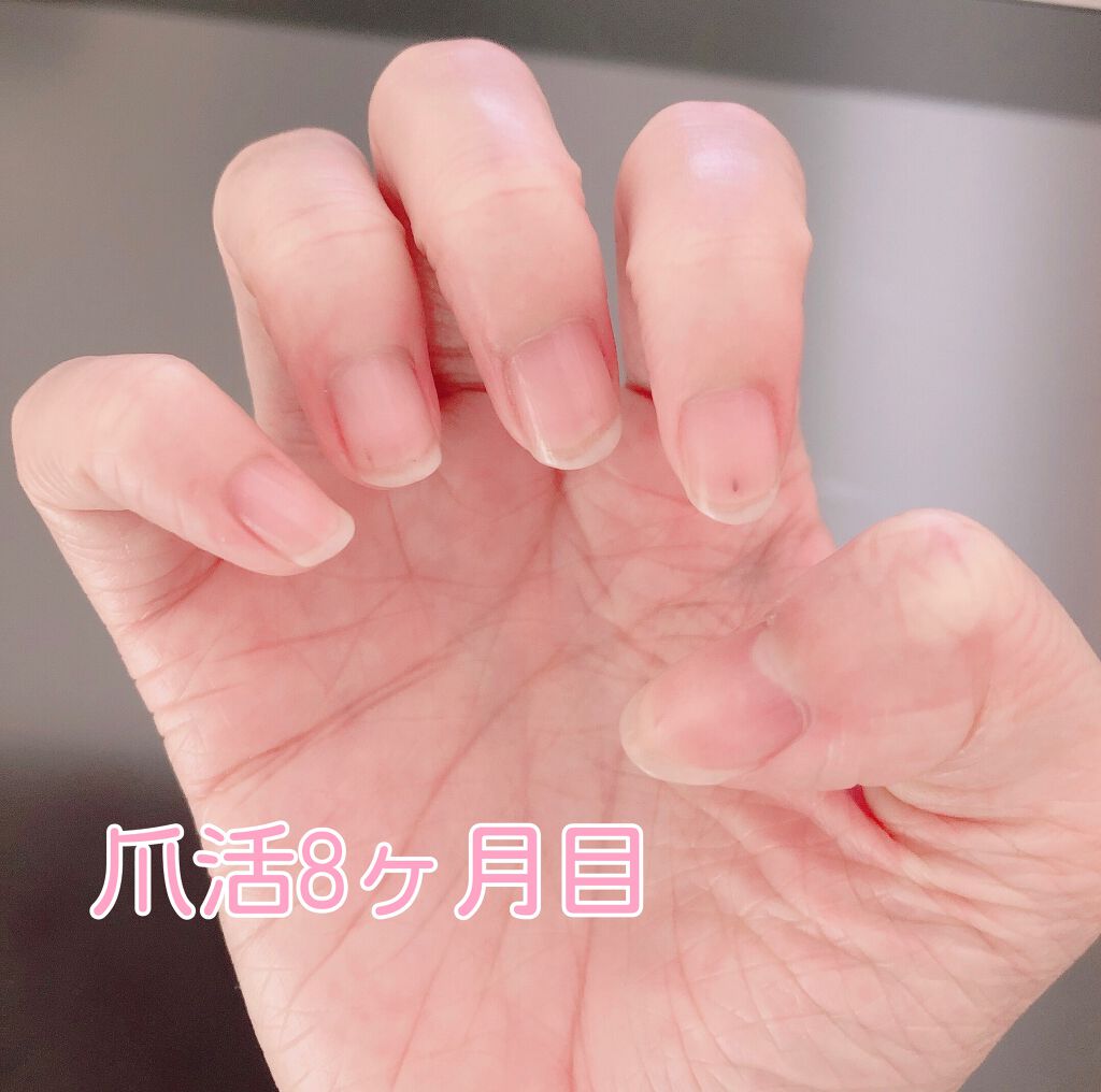 エテュセ クイックケアコート/ettusais/ネイルオイル・トリートメントを使ったクチコミ（1枚目）